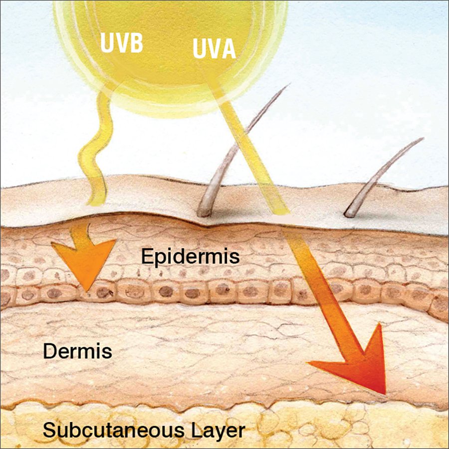UV rays and Cancer june