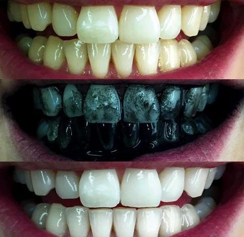 charcoal teeth whitening powder 31396832010 large