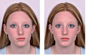 facial symmetry test Doctor Stus Science Blog